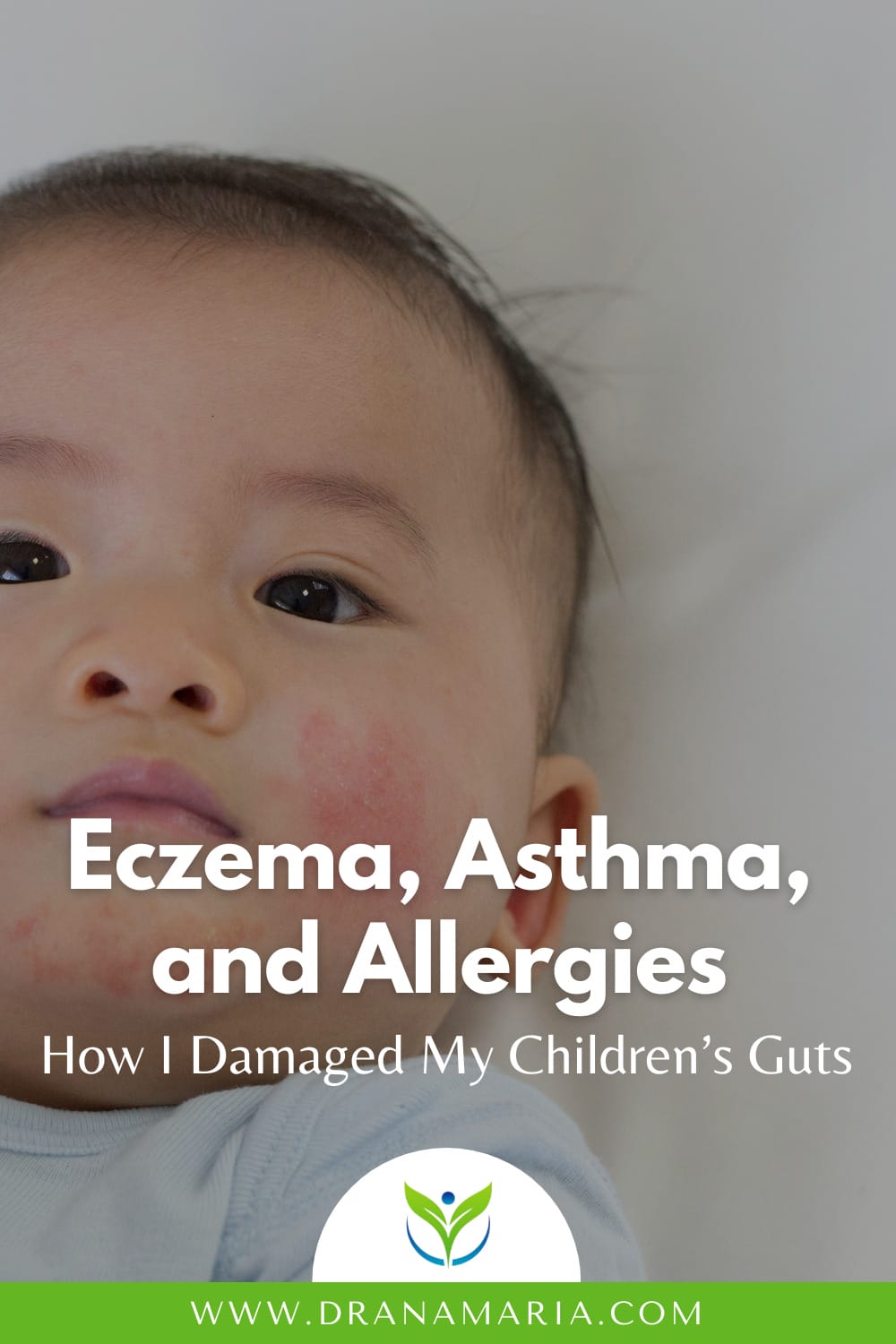 Eczema, Asthma, And Allergiesrstanding Eczema