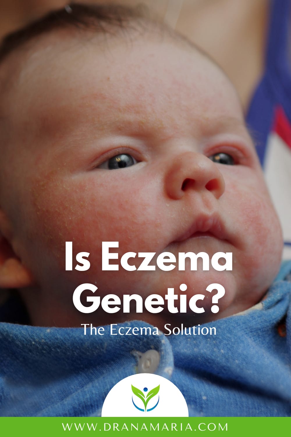 Is Eczema Genetic