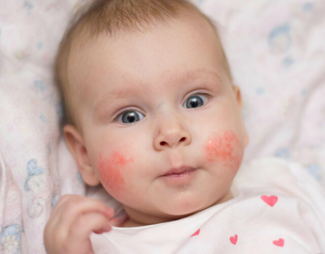 baby face