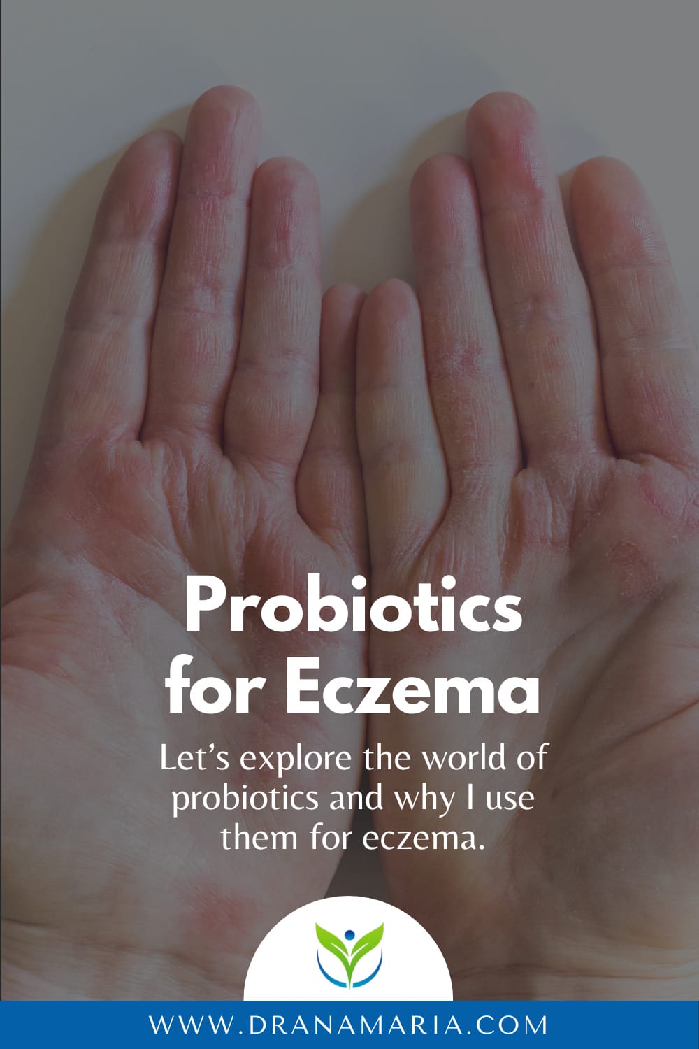 Probiotics For Eczema