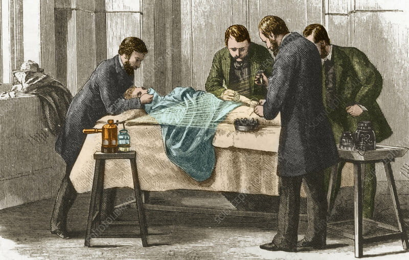 Lister's Antiseptic Spray, Surgery, 19th Century