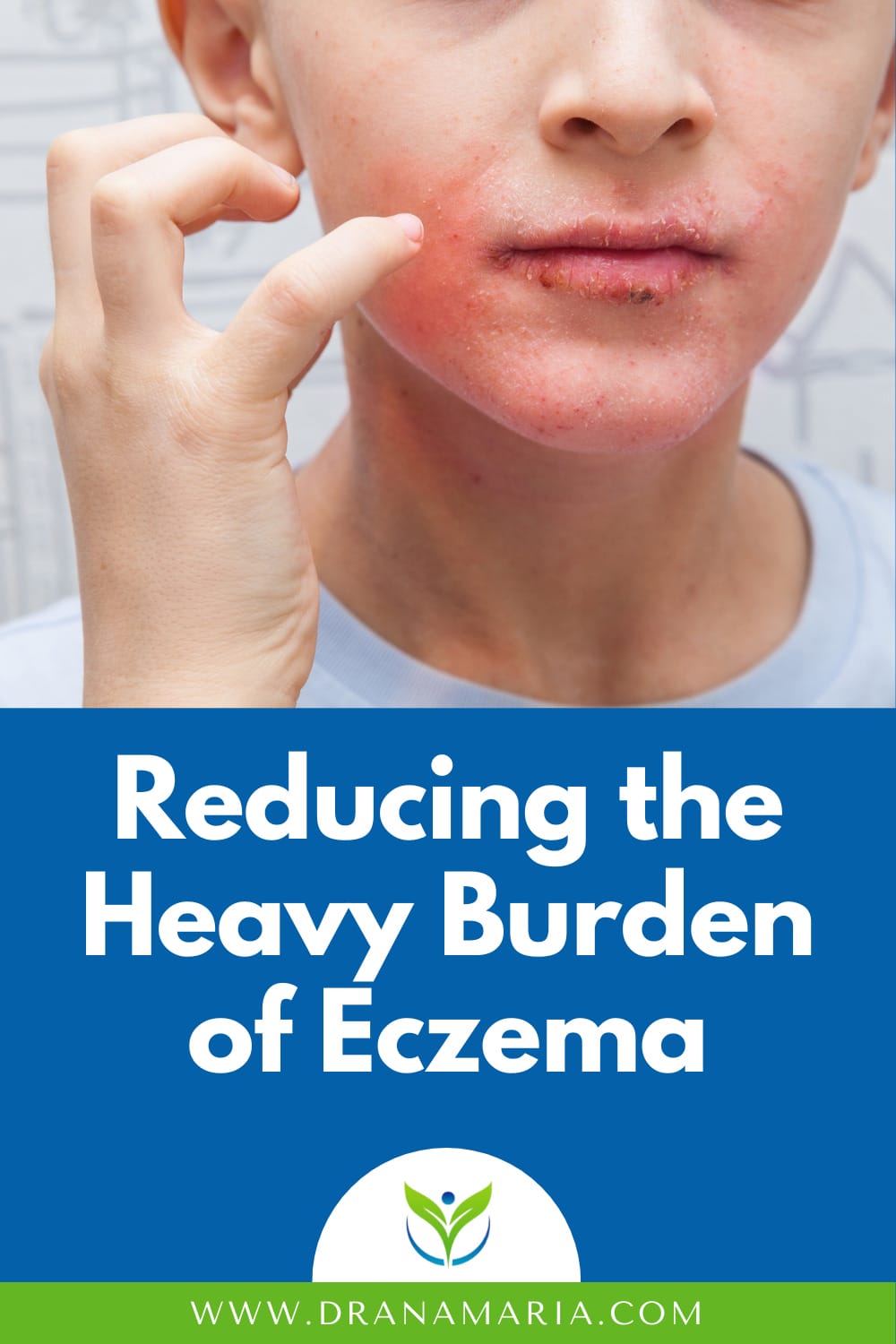 Reducing The Heavy Burden Of Eczema