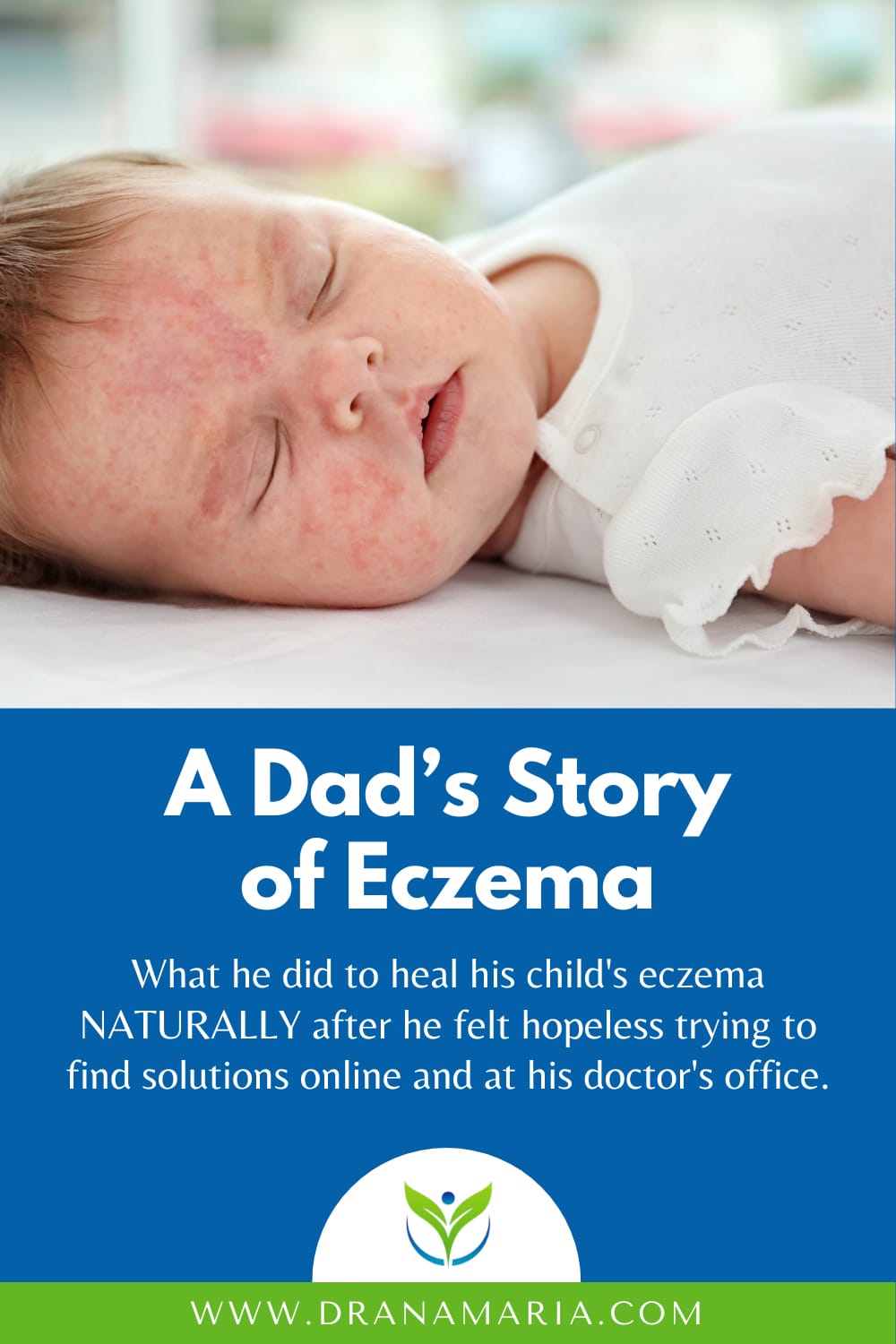 A Dad's Story Of Eczema