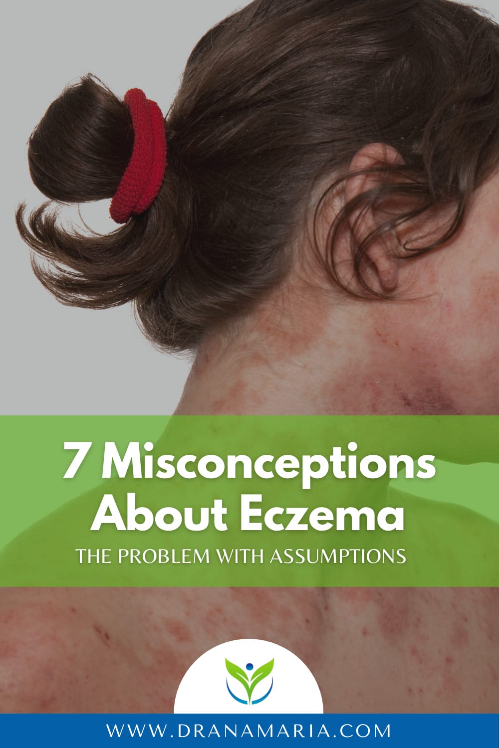 7 Misconceptions About Eczema