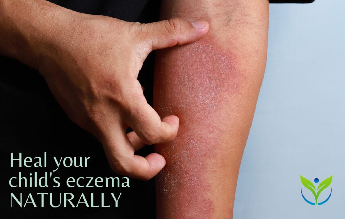 A Dad's Story of Eczema