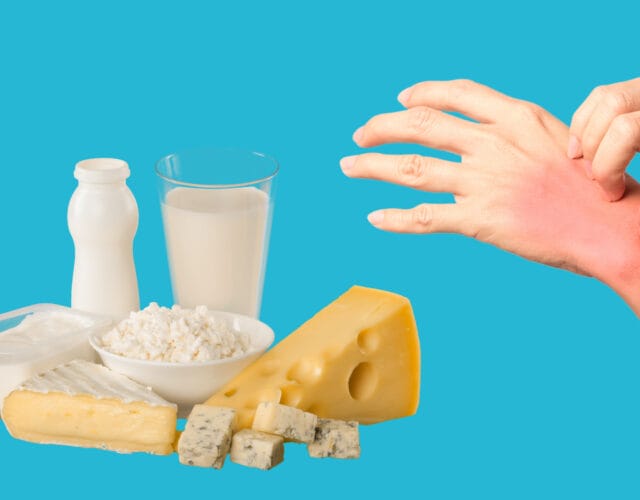 The Problem With Dairy And Eczema