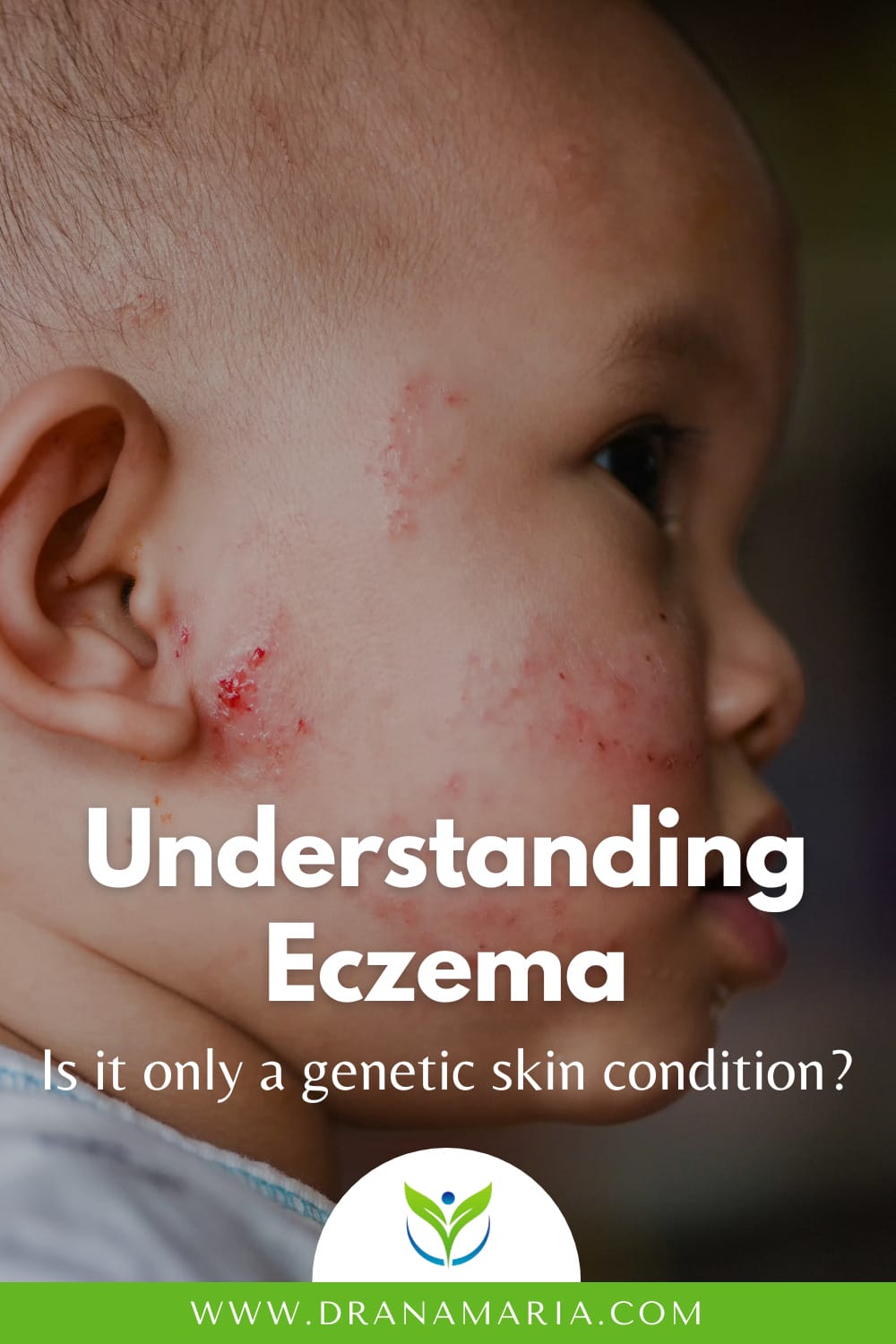 Understanding Eczema - Dr. Ana-Maria Temple